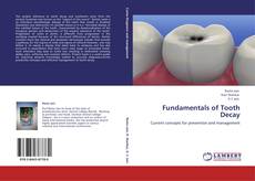 Couverture de Fundamentals of Tooth Decay