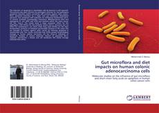 Bookcover of Gut microflora and diet impacts on human colonic adenocarcinoma cells