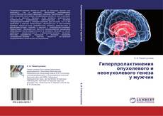 Buchcover von Гиперпролактинемия опухолевого и неопухолевого генеза у мужчин
