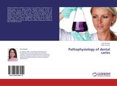 Bookcover of Pathophysiology of dental caries