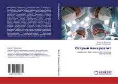 Bookcover of Острый панкреатит