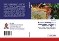 Capa do livro de Клеточная терапия язвенного колита и болезни Крона 