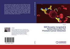 Capa do livro de NIR Receptor-targeted & Native Biomarker for Prostate Cancer Detection 