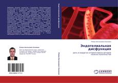 Bookcover of Эндотелиальная дисфункция