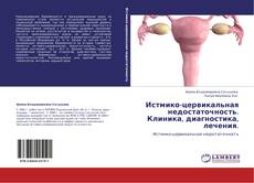 Bookcover of Истмико-цервикальная недостаточность. Клиника, диагностика, лечения.