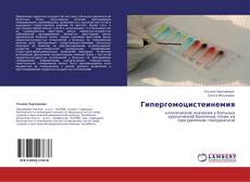 Buchcover von Гипергомоцистеинемия