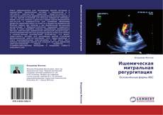 Bookcover of Ишемическая митральная регургитация