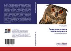 Bookcover of Лимфоцитарная инфильтрация