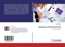 Copertina di Diagnosis of Dental Caries