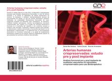 Capa do livro de Arterias humanas criopreservadas: estudio pre y post implante 