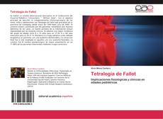 Tetralogía de Fallot kitap kapağı