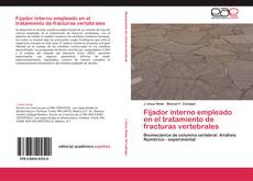 Bookcover of Fijador interno empleado en el tratamiento de fracturas vertebrales