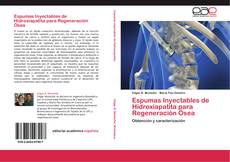 Bookcover of Espumas Inyectables de Hidroxiapatita para Regeneración Ósea