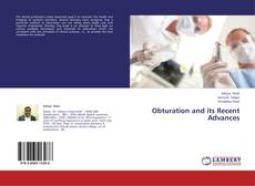 Buchcover von Obturation and its Recent Advances