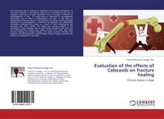Buchcover von Evaluation of the effects of Celecoxib on fracture healing