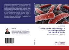 Capa do livro de Tooth Root Conditioning- A Scanning Electron Microscope Study 