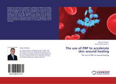 Bookcover of The use of PRP to accelerate skin wound healing