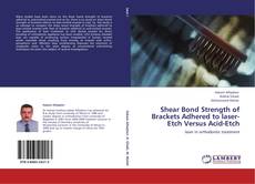 Bookcover of Shear Bond Strength of Brackets Adhered to laser-Etch Versus Acid-Etch