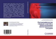 Bookcover of Патоморфология сердца у детей с транспозицией магистральных сосудов