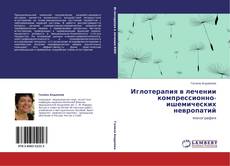Bookcover of Иглотерапия в лечении компрессионно-ишемических невропатий