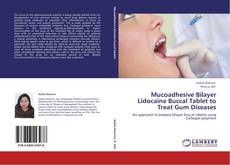 Bookcover of Mucoadhesive Bilayer Lidocaine Buccal Tablet to Treat Gum Diseases
