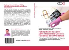 Copertina di Polimorfismo Fok I del VDR y Recambio Óseo en Pacientes con Ortodoncia