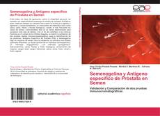 Buchcover von Semenogelina y Antígeno específico de Próstata en Semen