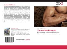 Bookcover of Varicocele bilateral