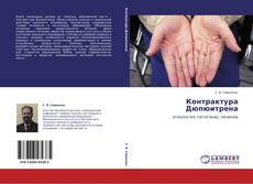 Bookcover of Контрактура Дюпюитрена
