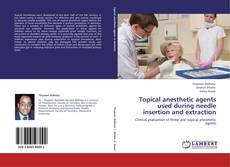 Bookcover of Topical anesthetic agents used during needle insertion and extraction