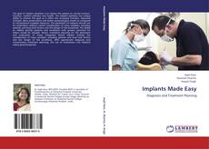 Bookcover of Implants Made Easy