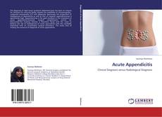 Bookcover of Acute Appendicitis