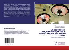 Buchcover von Оперативная эндоскопия при раке панкреатодуоденальной зоны