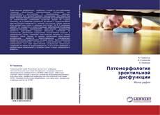 Buchcover von Патоморфология эректильной дисфункции