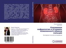 Bookcover of Кадмиевая нефропатия в условиях измененного обмена кальция