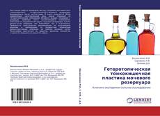 Bookcover of Гетеротопическая тонкокишечная пластика мочевого резервуара