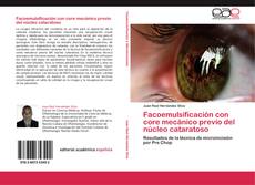Capa do livro de Facoemulsificación con core mecánico previo del núcleo cataratoso 