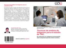 Copertina di Técnicas de análisis de imágenes para el estudio de TAC.