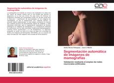 Bookcover of Segmentación automática de imágenes de mamografías