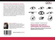 Expresión de p53 en patologías de conjuntiva kitap kapağı