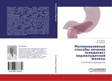 Capa do livro de Малоинвазивные способы лечения псевдокист поджелудочной железы 