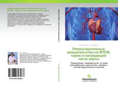 Buchcover von Реконструктивные вмешательства на ВТЛЖ, корне и восходящей части аорты
