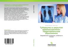 Buchcover von Туберкулез в закрытом административно-территориальном образовании