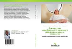 Bookcover of Асимметрия церебрального венозного дренажа в норме и патологии