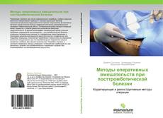 Capa do livro de Методы оперативных вмешательств при посттромботической болезни 