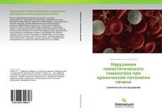 Copertina di Нарушения гемостатического гомеостаза при хронической патологии печени