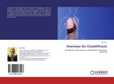 Overview On Cholelithiasis kitap kapağı