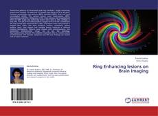 Buchcover von Ring Enhancing lesions on Brain Imaging