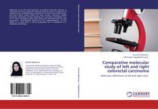 Buchcover von Comparative molecular study of left and right colorectal carcinoma