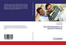 Oral Manifestations of Systemic Diseases的封面